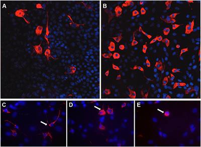 Pharmacological Investigations in Glia Culture Model of Inflammation